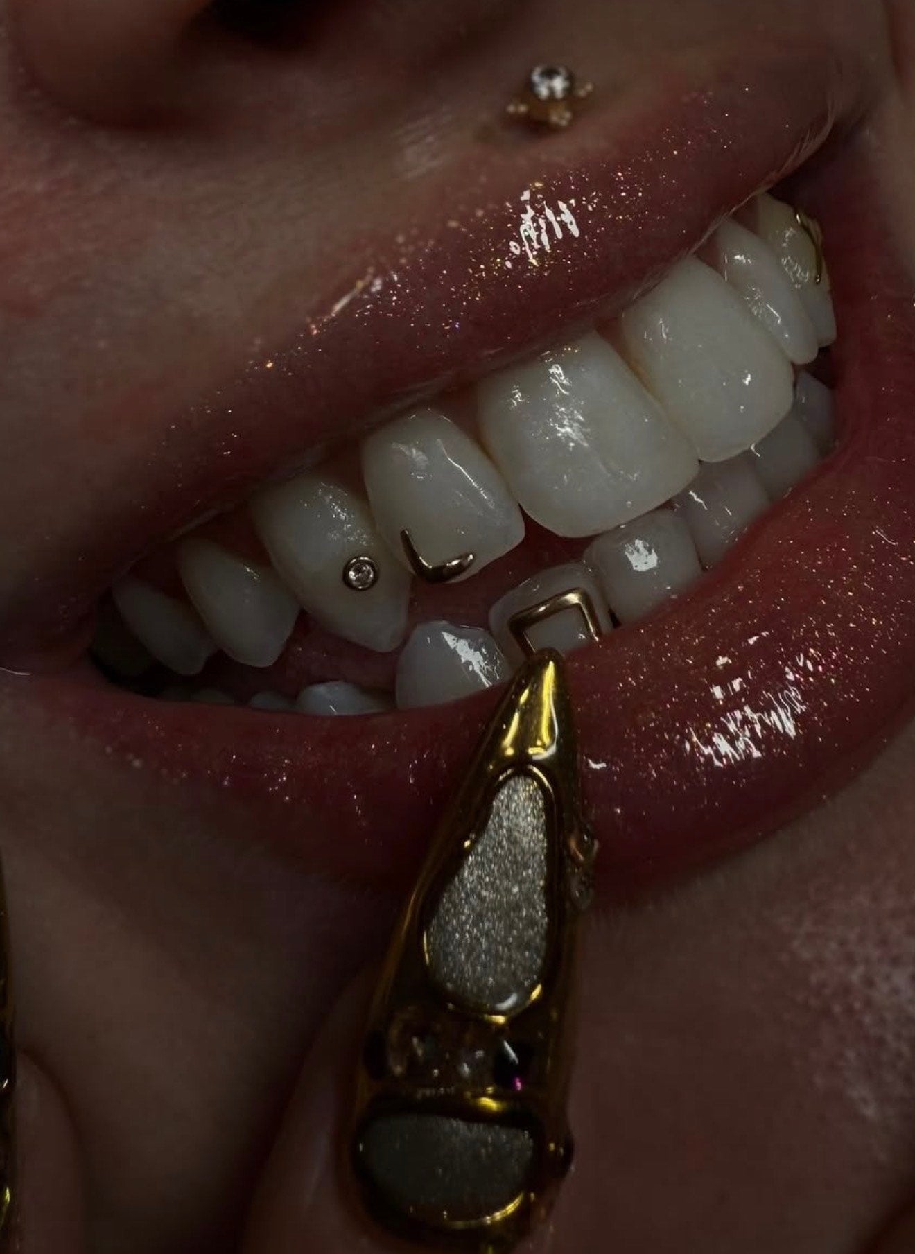 L Corner Tooth Gem Charm | Solid 18K Gold, Dental Safe