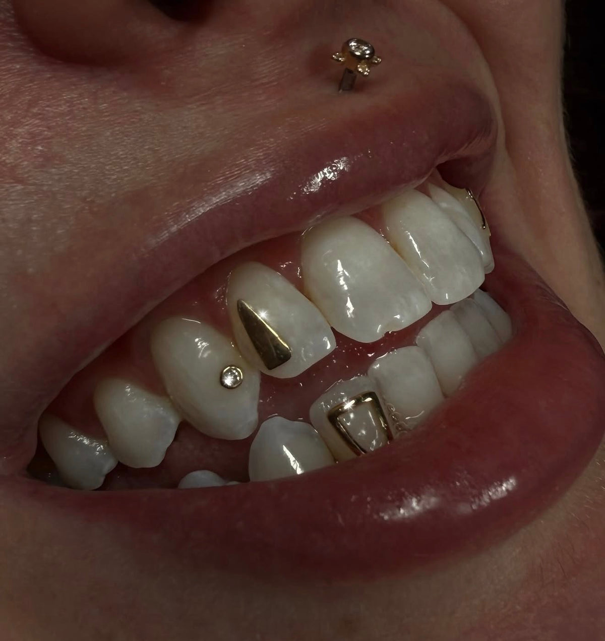 Incisor Window Frame 18k Gold Tooth Charm
