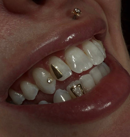 Incisor Window Frame 18k Gold Tooth Charm
