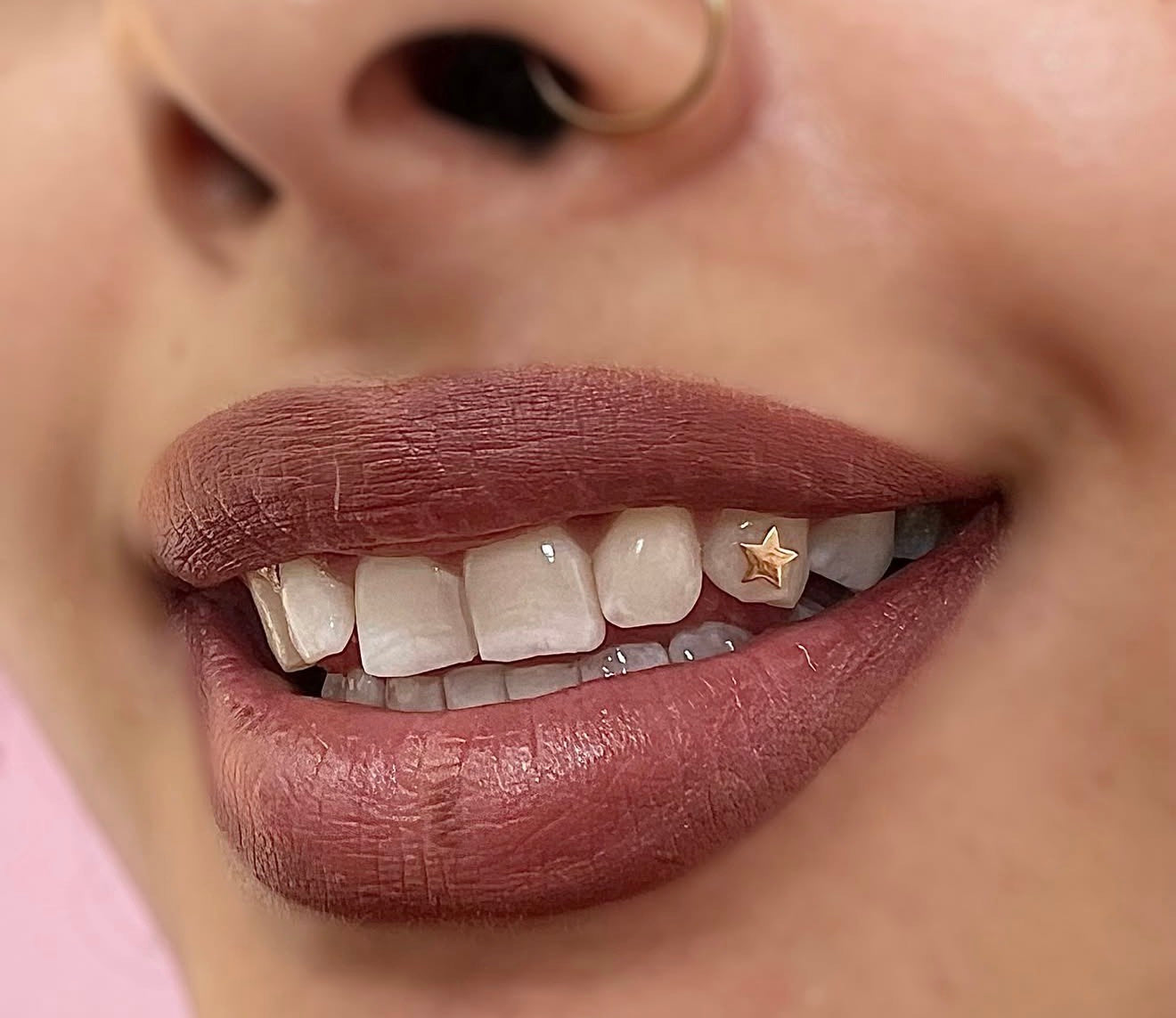 Solid Star Tooth Charm 18k Gold Tooth Charm